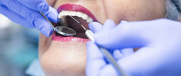 Best Emergency Dental Extractions in Keansburg, NJ